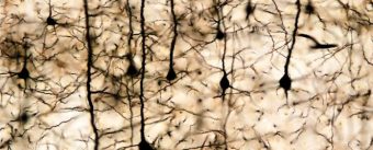 Brain-Neurons